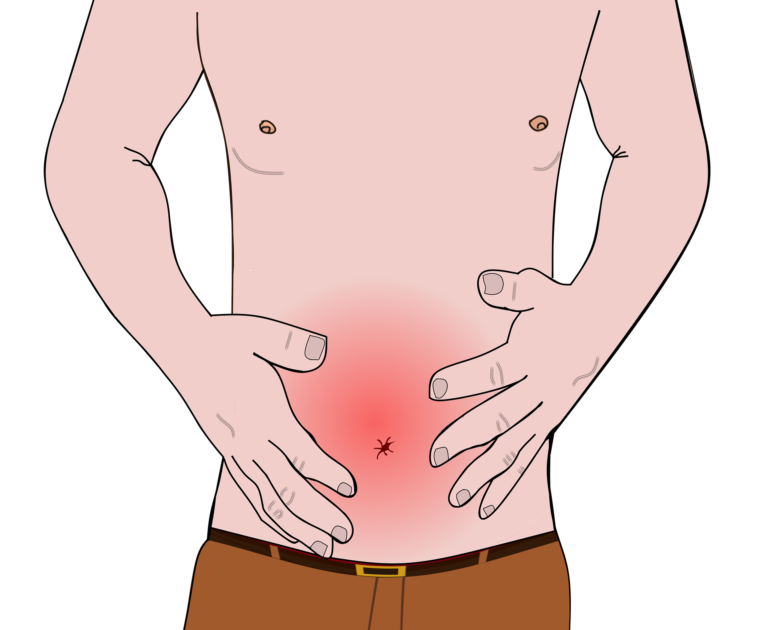 alimentation anti inflammatoire