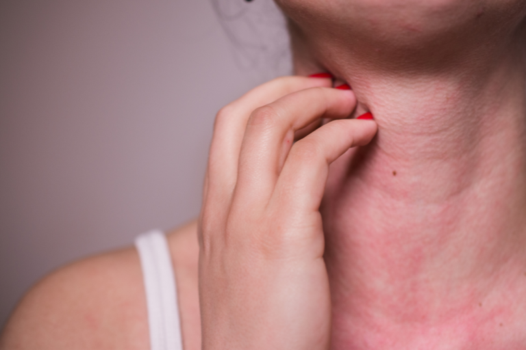 Intolérance, allergie, maladie… une naturopathe peut vous aider